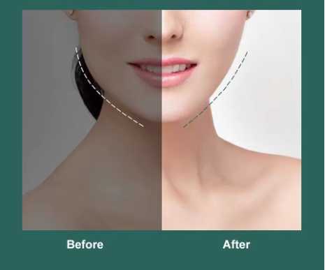 FACE LIFT UP BELTT